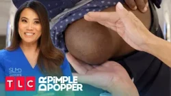 Pain in the Butt | Dr. Pimple Popper | TLC