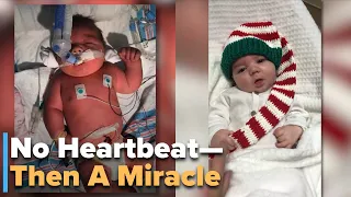 Miracle Baby Revived After 23 Minutes—Parents Say Jesus Healed Him